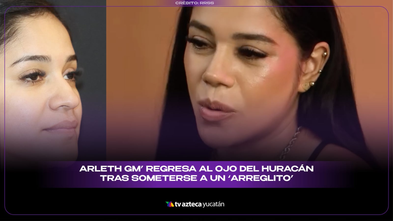 Arleth Gm’ regresa al OJO DEL HURACÁN tras someterse a un ‘arreglito’ con cuchillo