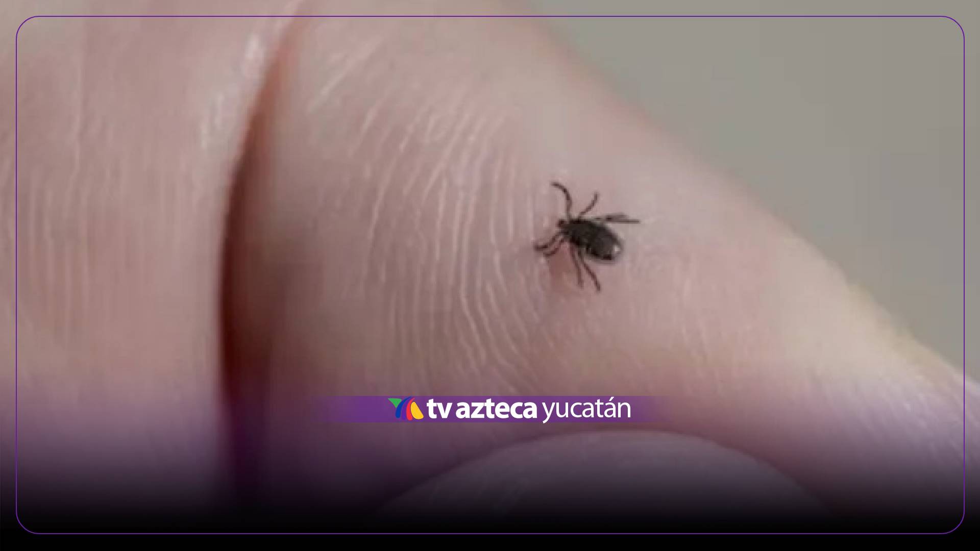 ¡Alarmante! Reportan MU3RE de ADOLESCENTE de 15 años por picadura de GARRAPATAS
