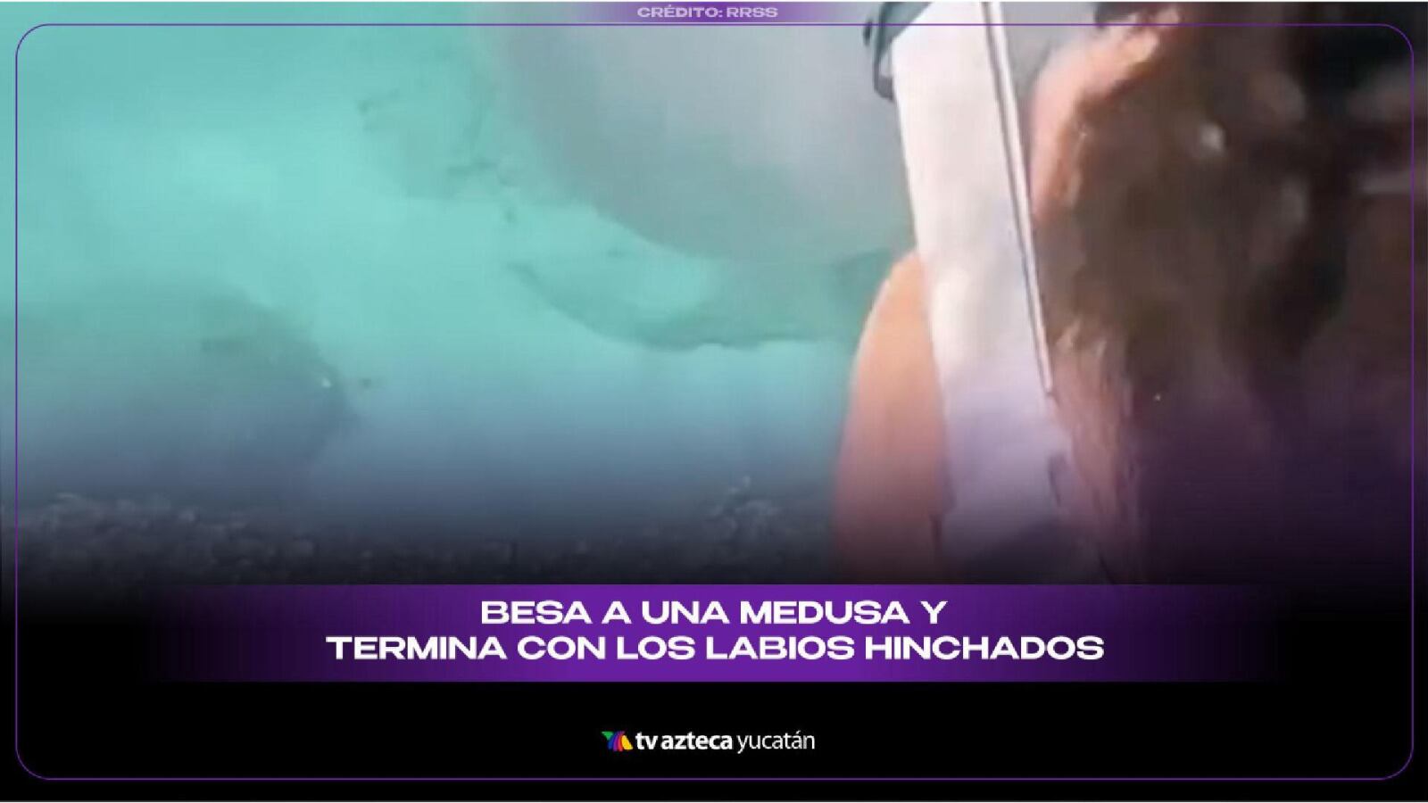 VIDEO: Besa a una MEDUSA y sufre dolorosa reacción en los LABIOS