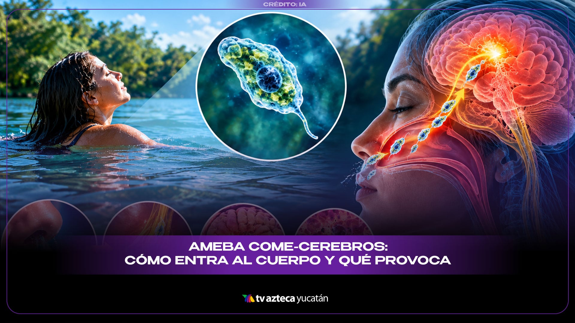¡ALERTA! Así ataca la PELIGROSA “ameba come-cerebros” (VIDEO)