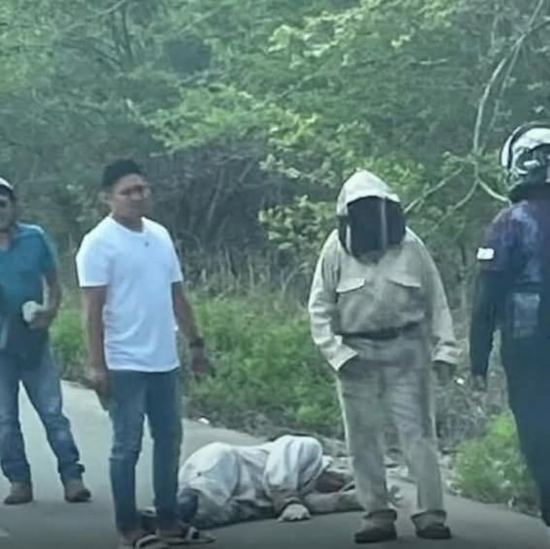 Ocurrió en Buctzotz_ Abuelito iba cruzando la calle y termina con FRACTURAS tras ser atropellado; ¿e.jpg